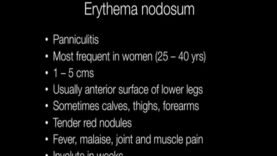 What is Erythema Nodosum – Pathology mini tutorial