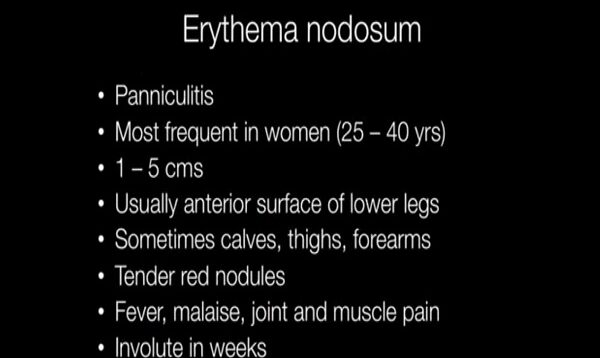 What is Erythema Nodosum – Pathology mini tutorial
