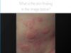 Dermatology Quiz
