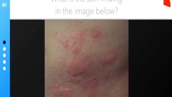 Dermatology Quiz