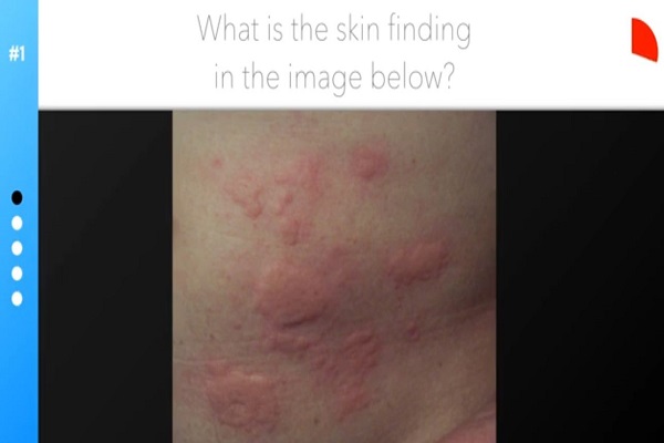 Dermatology Quiz