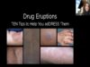 Drug Eruptions_ TEN tips to help you adDRESS them