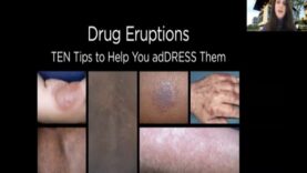 Drug Eruptions_ TEN tips to help you adDRESS them