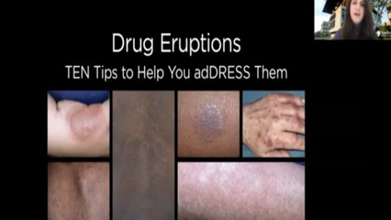 Drug Eruptions_ TEN tips to help you adDRESS them