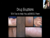 Drug Eruptions_ TEN tips to help you adDRESS them