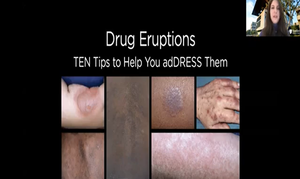 Drug Eruptions_ TEN tips to help you adDRESS them