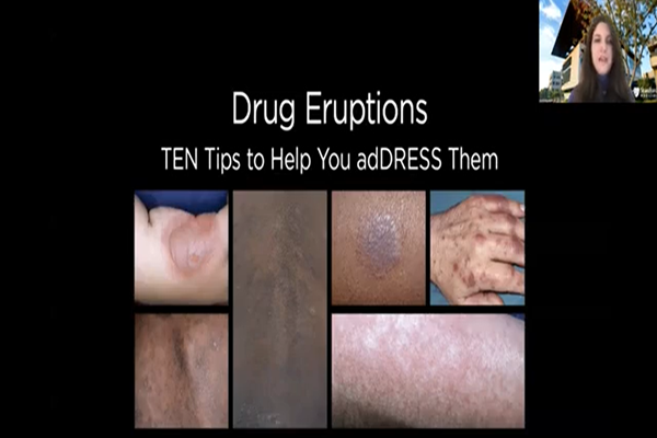 Drug Eruptions_ TEN tips to help you adDRESS them