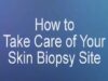 How to Take Care of Your Skin Biopsy Site