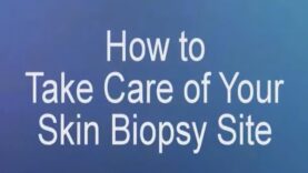 How to Take Care of Your Skin Biopsy Site