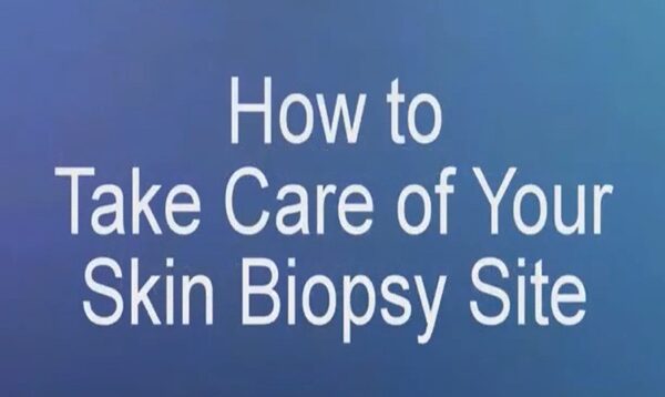 How to Take Care of Your Skin Biopsy Site