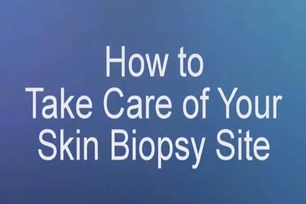 How to Take Care of Your Skin Biopsy Site