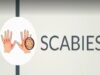 SCABIES, Causes, Signs and Symptoms, Diagnosis and Treatment